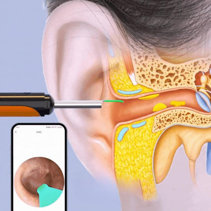 Aurikon - Ohrenreiniger mit Kamera