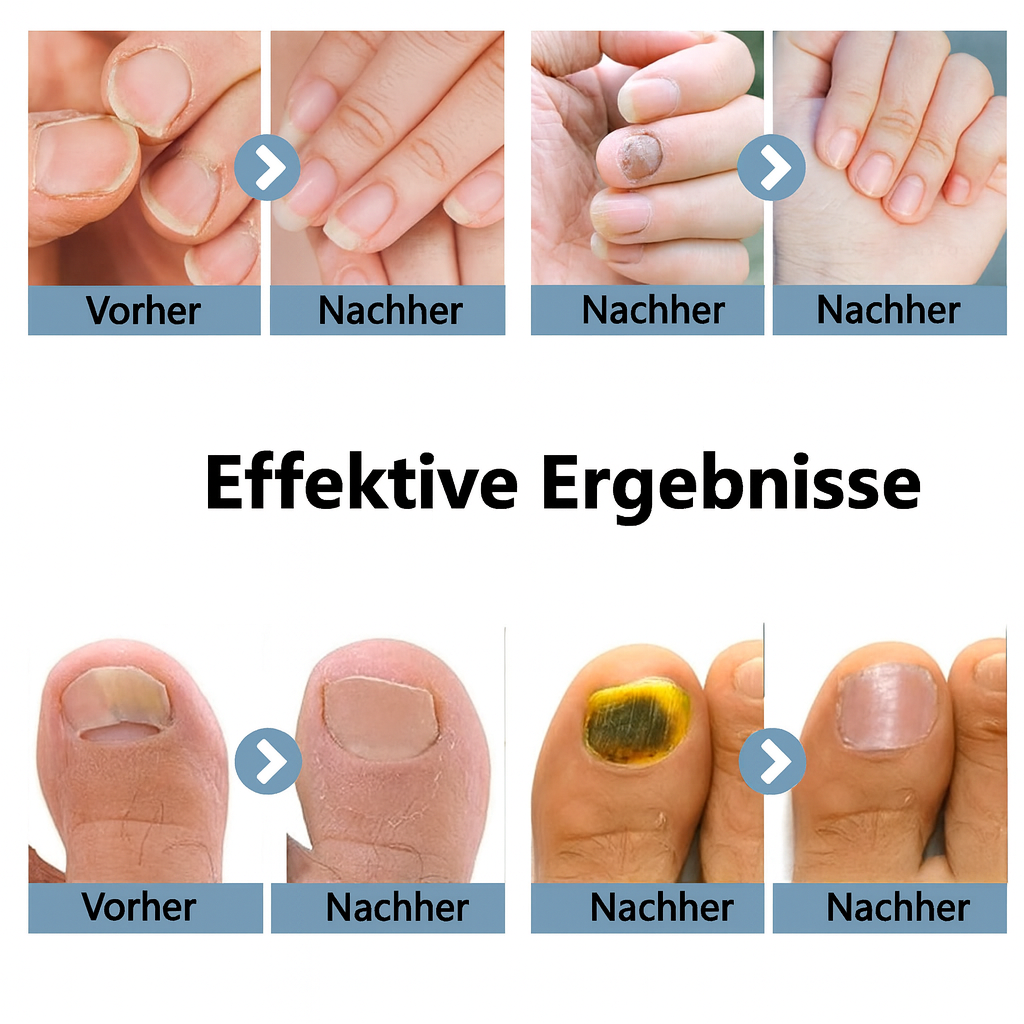 ReinLicht – Klarere Nägel durch moderne Lichtpflege