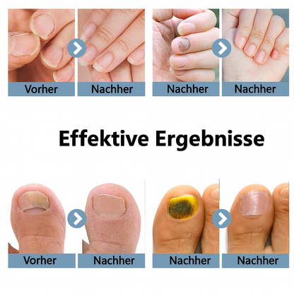 ReinLicht – Klarere Nägel durch moderne Lichtpflege