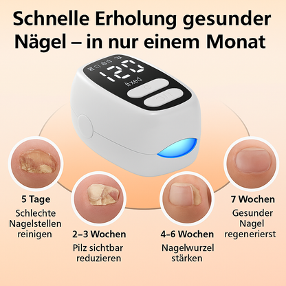 ReinLicht – Klarere Nägel durch moderne Lichtpflege