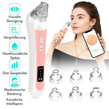 Vakuora - Mitesser-Entferner mit Kamera