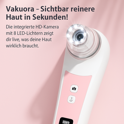 Vakuora - Mitesser-Entferner mit Kamera