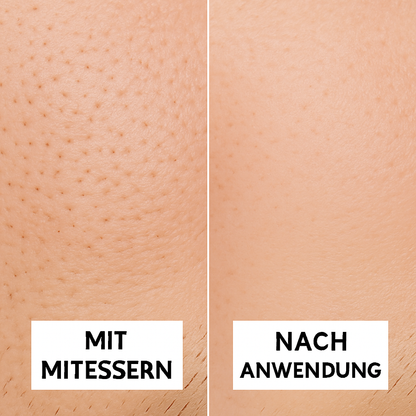 NorrPore - Mitesser-Nasenstreifen